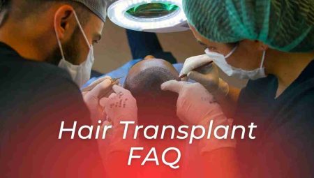 Hair Transplant FAQ – Frequently Asked Questions